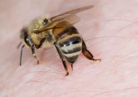 Bee venom has become a new favorite in the beauty