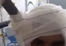 Бразилияда қуролланган ўғри Педро Феррейра бошига