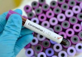 Koronavirus aniqlangan eng so‘nggi bemor haqida ma’lumot berildi фото