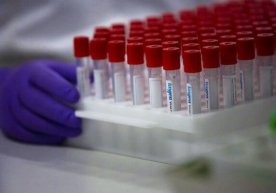 Bir kun ichida Toshkent viloyatidagi 19ta tuman va shaharda koronavirus aniqlandi фото