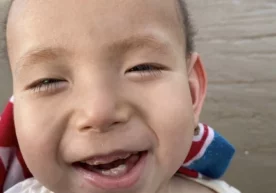 Фото: Weibo Хитойлик ота Менкес касаллигидан азият чекувчи