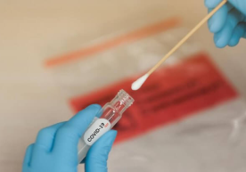 O‘zbekistonda koronavirusdan vafot etgan insonning yana ikki nafar qarindoshida virus aniqlandi фото