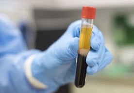 Koronavirus qayta yuqishi mumkinligi ilk bor isbotlandi фото