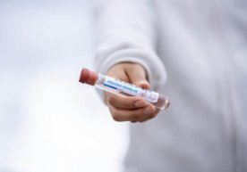 DSQ tizimidagi xodimdan koronavirus aniqlandi фото