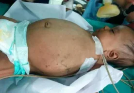 Бунақасини дунё аҳли жуда кам кўрган. Ҳиндистоннинг