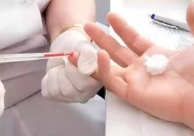 Клиник қон текшируви умумий саломатлик ҳолатини баҳолаш,