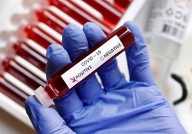 Ўзбекистонда коронавирус билан кунлик касалланиш ҳолати яна 600 кишидан камайди фото