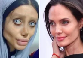 19 yoshli qiz kumiriga o‘xshash uchun 50 marta jarrohlik stoliga yotqizildi фото