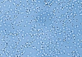 Висконсин-Медисон университети тадқиқотчилари синтетик