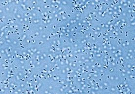 Висконсин-Медисон университети тадқиқотчилари синтетик