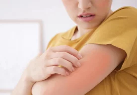 Фото: “Яндекс” Қуёшдан аллергия — ултрабинафша нурланиш