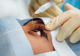 O‘zbekistonda bionik ko‘zlarning yangi avlodini implantatsiya qilish texnologiyasi yaratilishi mumkin фото