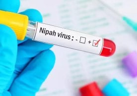 Қирғизистон 28 январдан бошлаб Ҳиндистондан Нипаҳ вирусига