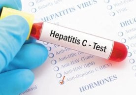 Ўзбекистонда гепатит “С” вирусига қарши дори воситасини