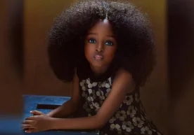 Nigeriyalik 5 yoshli jajji qizaloq Jara ikki yil avval