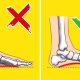 Flat feet (medically termed "pes planus") is