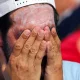 Прогулки на солнце полезны, но чрезмерное пребывание на