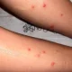Малдив оролларида сайёҳлар саломатлигига таҳдид солувчи