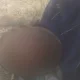 Toshkentda yuragi og‘riyotganini aytgan mast erkak