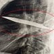 Танзанияда шифокорлар ноодатий ҳолатга дуч келишди: улар