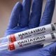 Isroilda hantavirus infeksiyasi bilan kasallanishning
