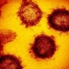 Fransiyalik olimlar "Tojdor virus" qanday haroratda nobud bo‘lishini aniqladi