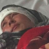 Erkak rashk sababli rafiqasining ikki qulog‘ini kesib tashladi