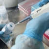 O‘zbekistonda 8 ta xususiy tibbiyot muassasasida koronavirusga test topshirish mumkinligi aytildi
