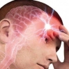 Koronavirus infeksiyasi insult va epilepsiyaga olib kelishi mumkin