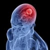 Олимлар саратоннинг ривожланишини тўхтатишга қодир бўлган дори воситасини яратдилар