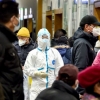 Хитойлик шифокорлар янги коронавируснинг дастлабки аломатларини маълум қилишди