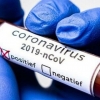 Ўзбекистонда коронавирусдан зарарланиш ҳолатлари сони 2741тага етди
