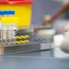 Qozog‘istonda koronavirus uchun ommaviy test o‘tkazish boshlanadi
