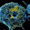Koronavirus: o‘lim holatining asosiy omillari
