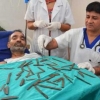 Bir erkakning oshqozonidan 40 ta metall buyum topildi