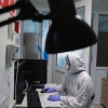Россиялик шифокор коронавируснинг энг ваҳимали симптомини айтди