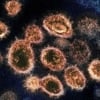 Koronavirus inson immunitetining asosiy hujayralaridan biriga zarar yetkazishi aniqlandi