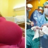 23 yoshli ayol besh egizak farzandni dunyoga keltirdi (foto)