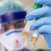 Yana 10 kishida koronavirus topildi