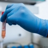 Koronavirus qanday haroratda o‘lishi haqida tadqiqot o‘tkazildi