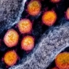 Koronavirus mutatsiyaga uchradi: biri ikkinchisidan zararliroq va ko‘proq uchramoqda