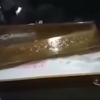 Braziliyada shifokorlar xatosi tufayli 37 yoshli ayol tiriklay ko‘mildi (video)