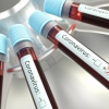 Qozog‘iston poytaxtida ham koronavirus qayd etildi