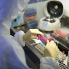 Rossiyada 2 nafar ayol koronavirus bo‘yicha karantindan qochib ketdi