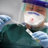 Germaniyalik olimlar koronavirus tarqalishining ssenariysini bashorat qilishdi