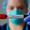Қозоғистонда коронавирус юқтирганлар сони бир кунда уч баравар ошди