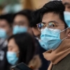 Epidemiolog: koronavirusning belgisiz tashuvchilari ham bor