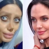 19 yoshli qiz kumiriga o‘xshash uchun 50 marta jarrohlik stoliga yotqizildi