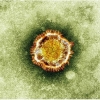 Olimlar koronavirus qanday haroratda yashay olishini aniqladi