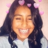 13 yoshli o’smir qiz hunuk tishlari sabab o’z joniga qasd qildi